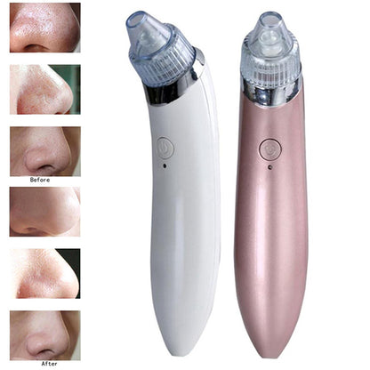 Multifunctional Beauty Pore Vacuum